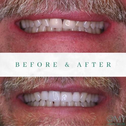  My Gilroy Dentist | Dentures, Teeth Whitening and Pediatric Dentistry