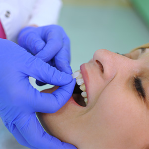 Granger Dentistry | Dental Fillings, VELscope reg  Cancer Screening and Cosmetic Dentistry