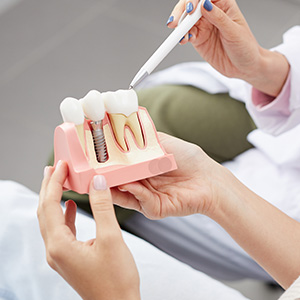 Granger Dentistry | Invisalign reg , Dentures and Air Abrasion